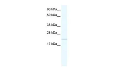 Anti-GTL3 antibody, C-term used in Western Blot (WB). GTX48956