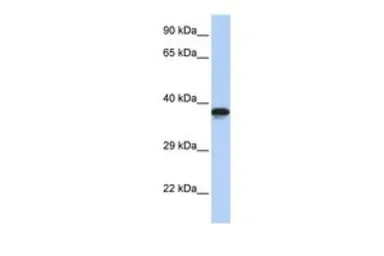 Anti-DMRTC2 antibody, N-term used in Western Blot (WB). GTX48962