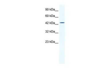 Anti-DMRTB1 antibody, Internal used in Western Blot (WB). GTX48963
