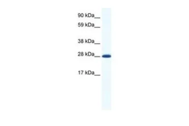 Anti-DLX4 antibody, N-term used in Western Blot (WB). GTX48970