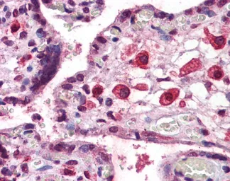 Anti-TBR2 / Eomes antibody, C-term used in IHC (Paraffin sections) (IHC-P). GTX48980