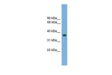 Anti-HOXA1 antibody, C-term used in Western Blot (WB). GTX48982