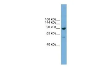 Anti-DDX54 antibody, C-term used in Western Blot (WB). GTX48985