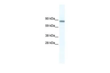 Anti-p66 alpha antibody, N-term used in Western Blot (WB). GTX48987
