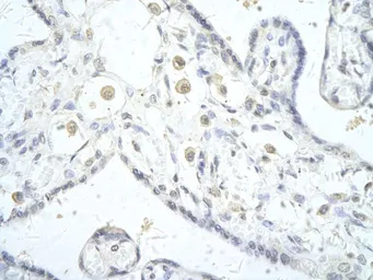 Anti-DLX5 antibody, C-term used in IHC (Paraffin sections) (IHC-P). GTX48999