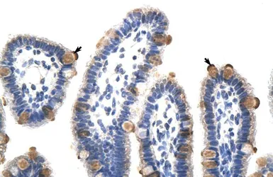 Anti-GTF3C5 antibody, C-term used in IHC (Paraffin sections) (IHC-P). GTX49000