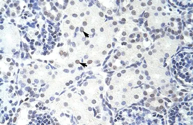 Anti-GMEB2 antibody, C-term used in IHC (Paraffin sections) (IHC-P). GTX49002