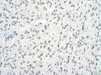 Anti-GMEB2 antibody, C-term used in IHC (Paraffin sections) (IHC-P). GTX49002