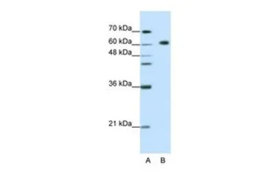 Anti-GMEB2 antibody, C-term used in Western Blot (WB). GTX49002