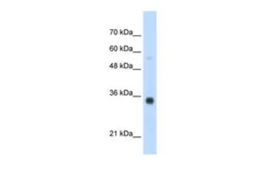 Anti-HOXB4 antibody, N-term used in Western Blot (WB). GTX49003