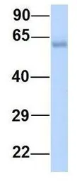 Anti-DACH1 antibody, N-term used in Western Blot (WB). GTX49004