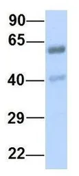 Anti-DACH1 antibody, N-term used in Western Blot (WB). GTX49004
