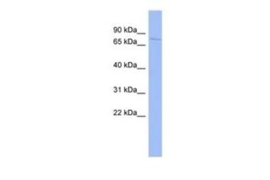 Anti-HDX antibody, Internal used in Western Blot (WB). GTX49006