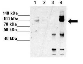 Anti-HNRPUL1 antibody, C-term used in Immunoprecipitation (IP). GTX49009