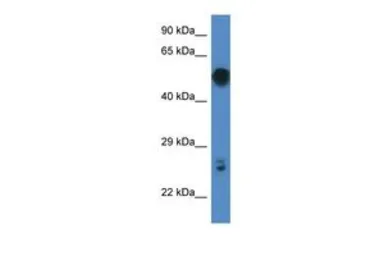 Anti-Gal3st4 antibody, C-term used in Western Blot (WB). GTX49031