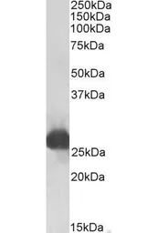 Anti-GSTA1 antibody used in Western Blot (WB). GTX49056