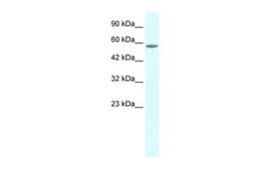 Anti-GTF2E1 antibody, C-term used in Western Blot (WB). GTX49059