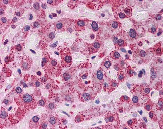 Anti-ENO1 antibody, Internal used in IHC (Paraffin sections) (IHC-P). GTX49060