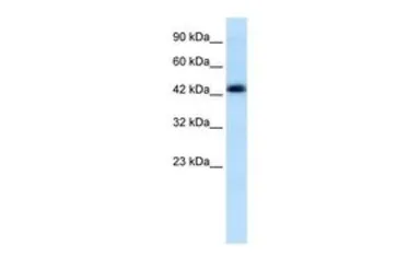 Anti-ENO1 antibody, Internal used in Western Blot (WB). GTX49060