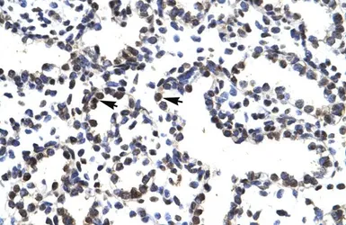Anti-LHX3 antibody, Internal used in IHC (Paraffin sections) (IHC-P). GTX49065