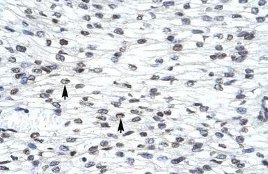 Anti-LHX3 antibody, Internal used in IHC (Paraffin sections) (IHC-P). GTX49065