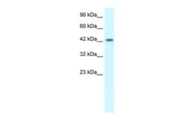 Anti-LHX3 antibody, Internal used in Western Blot (WB). GTX49065