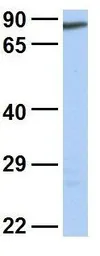 Anti-LAS1L antibody, C-term used in Western Blot (WB). GTX49067