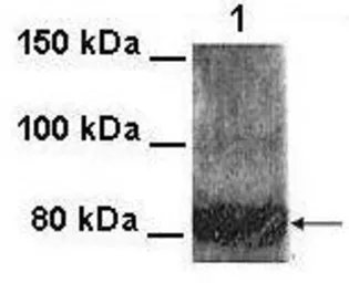 Anti-KCNQ4 antibody, Internal used in Western Blot (WB). GTX49069