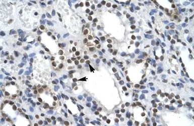 Anti-ILF2 antibody, C-term used in IHC (Paraffin sections) (IHC-P). GTX49071