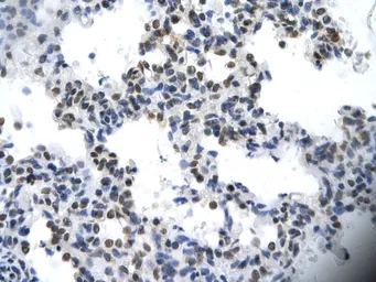 Anti-ILF2 antibody, C-term used in IHC (Paraffin sections) (IHC-P). GTX49071