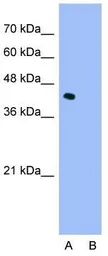 Anti-ILF2 antibody, C-term used in Western Blot (WB). GTX49071