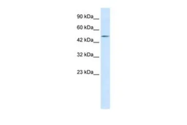 Anti-LHX9 antibody, C-term used in Western Blot (WB). GTX49073