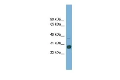 Anti-MXD1 antibody, C-term used in Western Blot (WB). GTX49077
