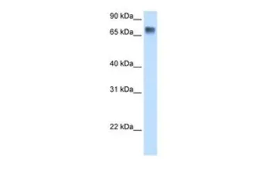 Anti-LSR antibody, C-term used in Western Blot (WB). GTX49086