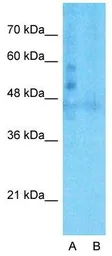 Anti-LSR antibody, C-term used in Western Blot (WB). GTX49086