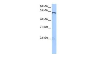 Anti-LIN9 antibody, N-term used in Western Blot (WB). GTX49104