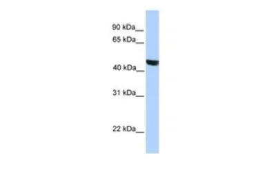 Anti-MSL3P1 antibody, Internal used in Western Blot (WB). GTX49105