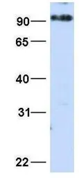 Anti-MICALL1 antibody, N-term used in Western Blot (WB). GTX49107