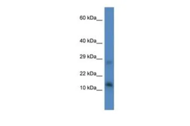 Anti-Lyrm4 antibody, Internal used in Western Blot (WB). GTX49111