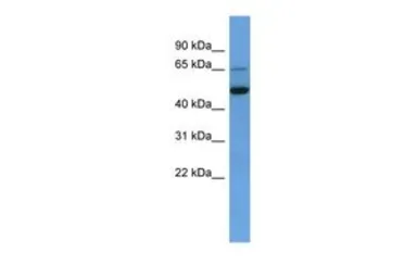 Anti-IQCB1 antibody, C-term used in Western Blot (WB). GTX49116