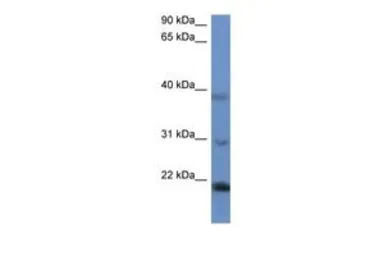 Anti-IMMP2L antibody, N-term used in Western Blot (WB). GTX49120