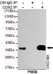 Anti-CDX2 antibody [4B9-B12-E9] used in Immunoprecipitation (IP). GTX49136