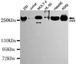Anti-CHD4 antibody [5F1-A11-C9] used in Western Blot (WB). GTX49139