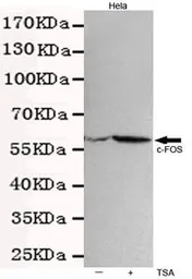 Anti-c-Fos antibody [7D6-A9-D4] used in Western Blot (WB). GTX49154