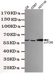 Anti-c-Fos antibody [7D6-A9-D4] used in Western Blot (WB). GTX49154