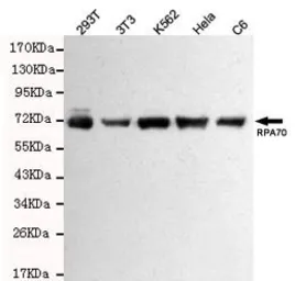 Anti-RPA70 antibody [8C3-D12-H10] used in Western Blot (WB). GTX49157