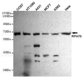 Anti-RPA70 antibody [8C3-D12-H10] used in Western Blot (WB). GTX49157