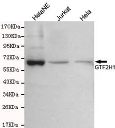 Anti-GTF2H1 antibody [3E8-D3-H8] used in Western Blot (WB). GTX49172
