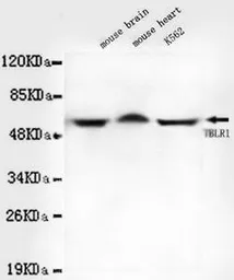 Anti-TBLR1 antibody [4F3-A8-D9] used in Western Blot (WB). GTX49189