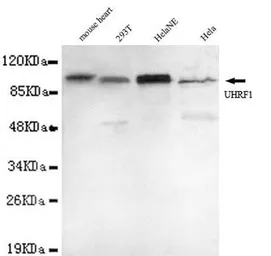 Anti-UHRF1 antibody [1H9-D3-E11] used in Western Blot (WB). GTX49190